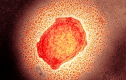 New HPRU-EZI study finds that monkeypox can spread widely within specialist hospital isolation rooms